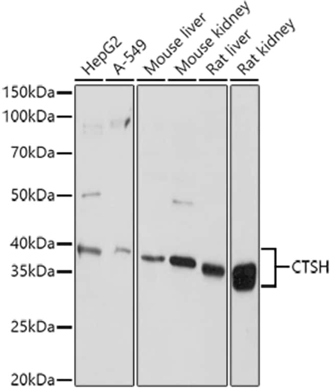 100UL CATHEPSIN H ANTIBODY 100 ul