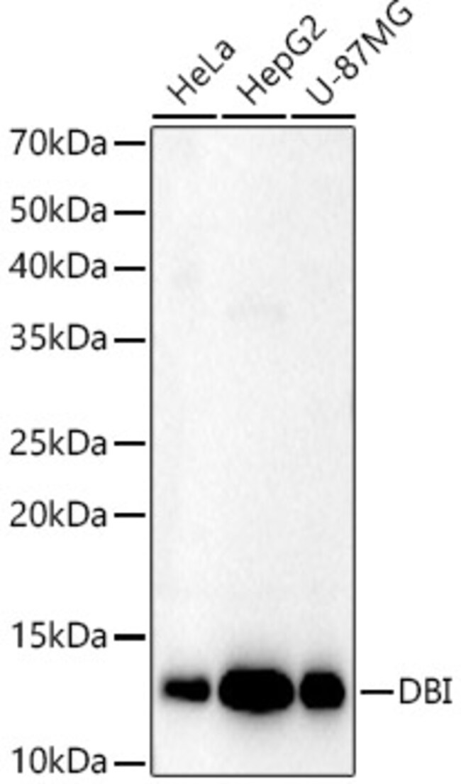 100UL DBI ANTIBODY 100 ul