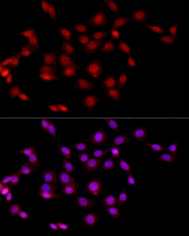 100UL EED ANTIBODY 100 ul