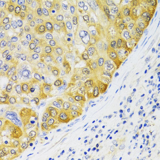 100UL EBP1 ANTIBODY 100 ul