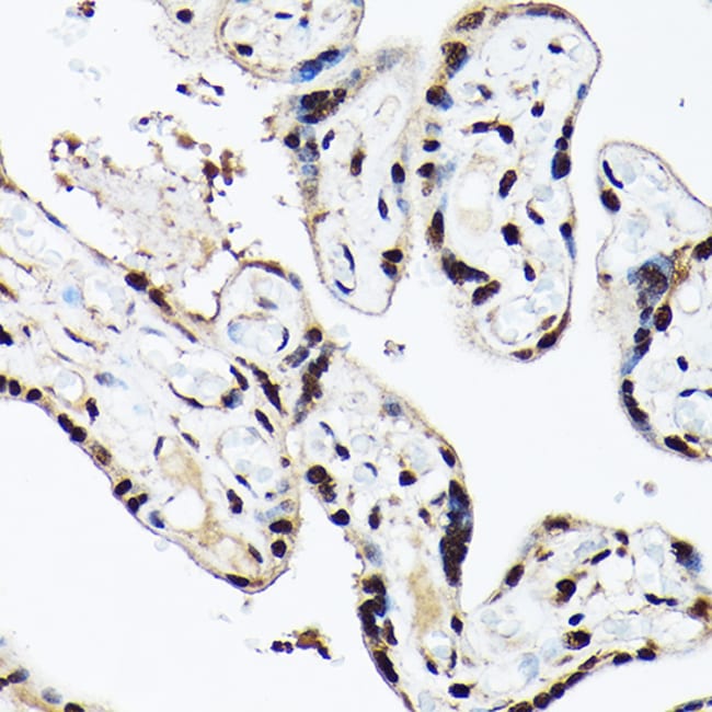 100UL BAF53A ANTIBODY 100 ul
