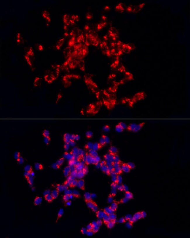 100UL CARTPT ANTIBODY 100 ul