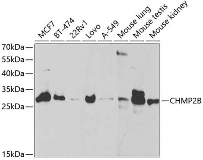 100UL CHMP2B ANTIBODY 100 ul