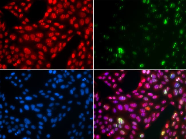 100UL CULLIN 4B ANTIBODY 100 ul