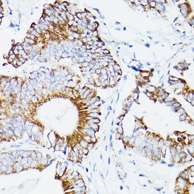 100UL DLD ANTIBODY 100 ul