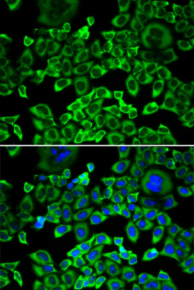 100UL EIF4B ANTIBODY 100 ul