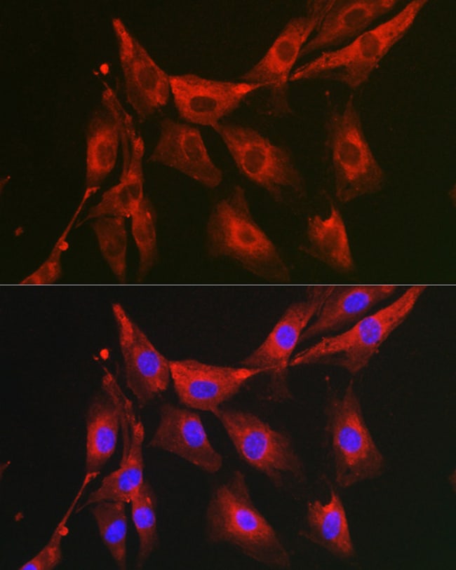 100UL FBP1 ANTIBODY 100 ul