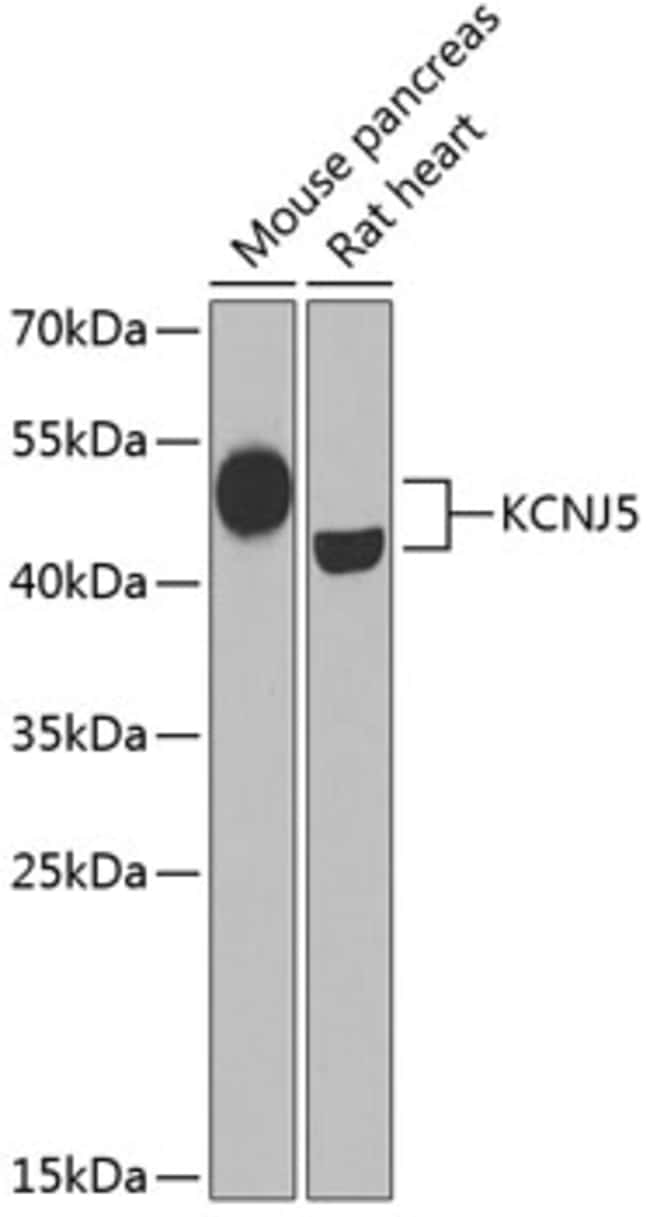 100UL KIR3.4 (KCNJ5) ANTIBODY 100 ul