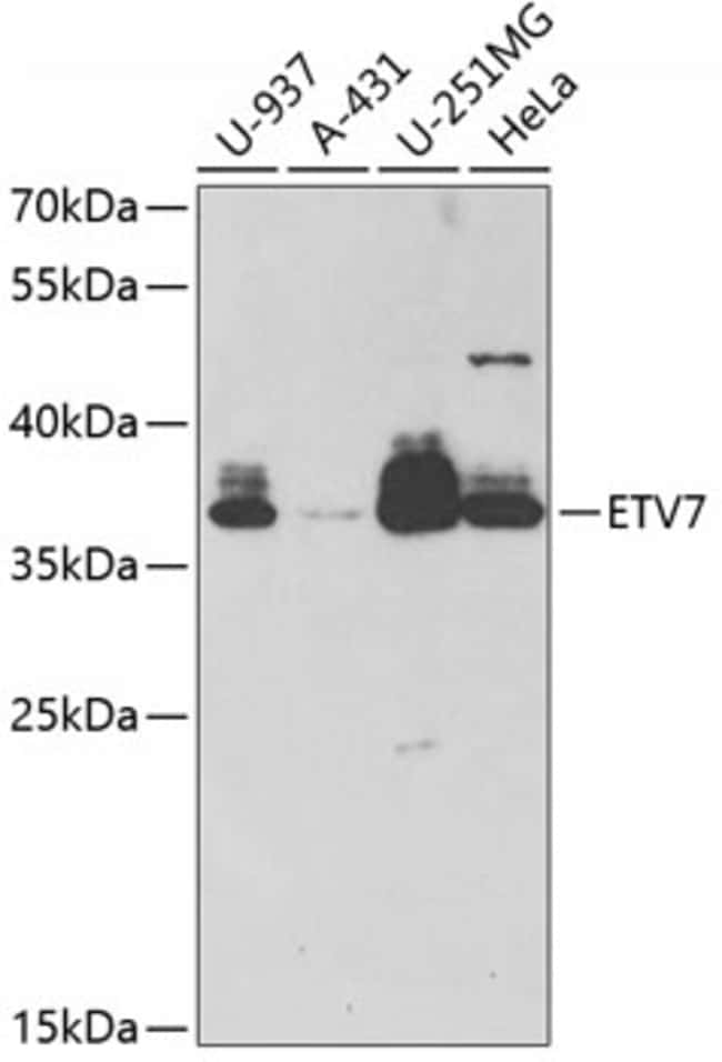 100UL ETV7 ANTIBODY 100 ul
