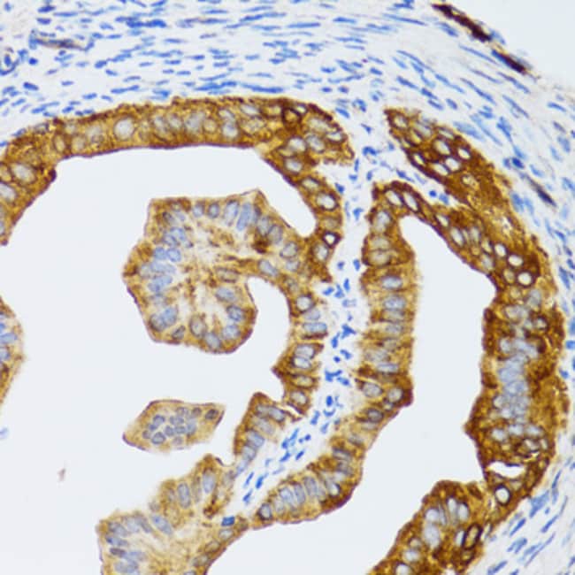 100UL CAF1 P60 ANTIBODY 100 ul