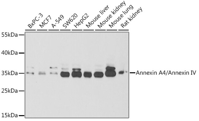 100UL ANNEXIN A4 ANTIBODY 100 ul