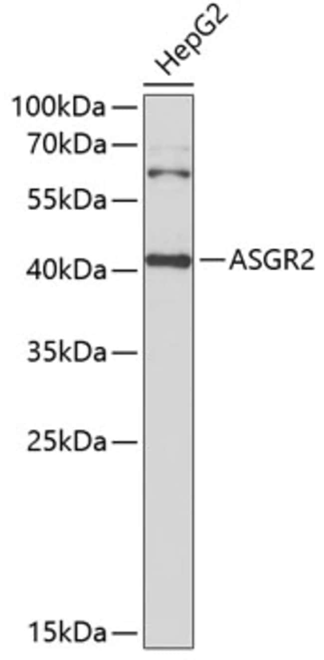 100UL ASGR2 ANTIBODY 100 ul