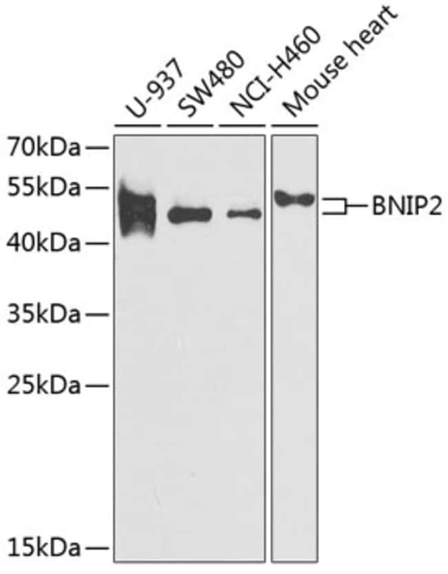 100UL BNIP2 ANTIBODY 100 ul