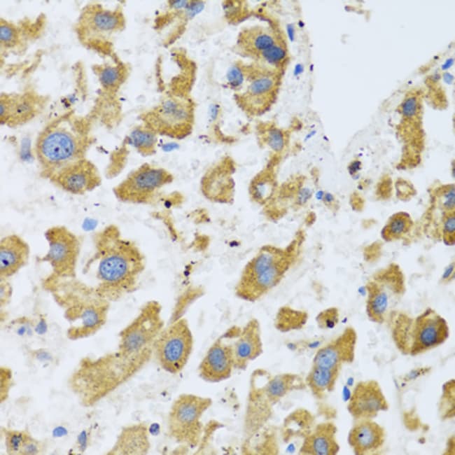 100UL BTD ANTIBODY 100 ul
