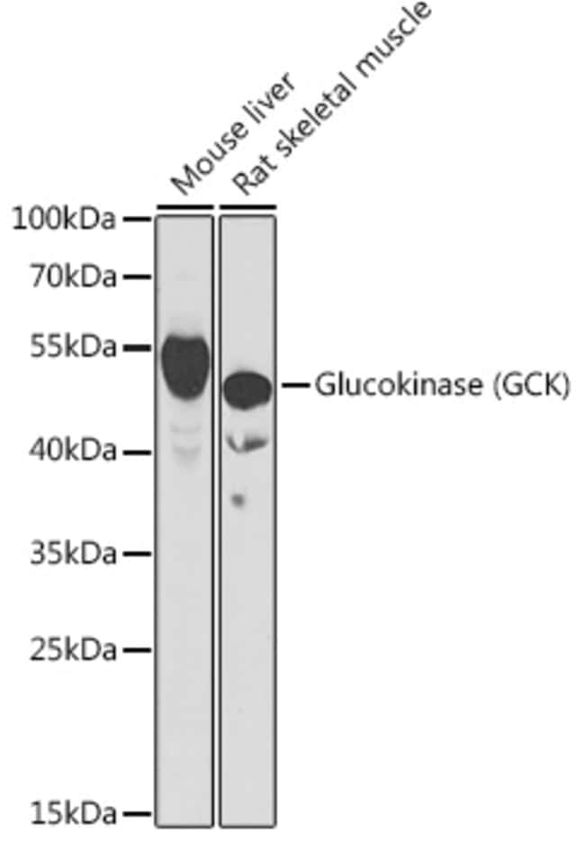100UL GCK ANTIBODY 100 ul