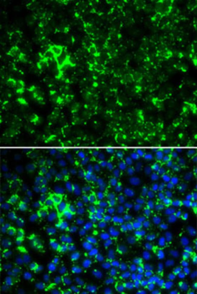 100UL KV1.2 (KCNA2) ANTIBODY 100 ul