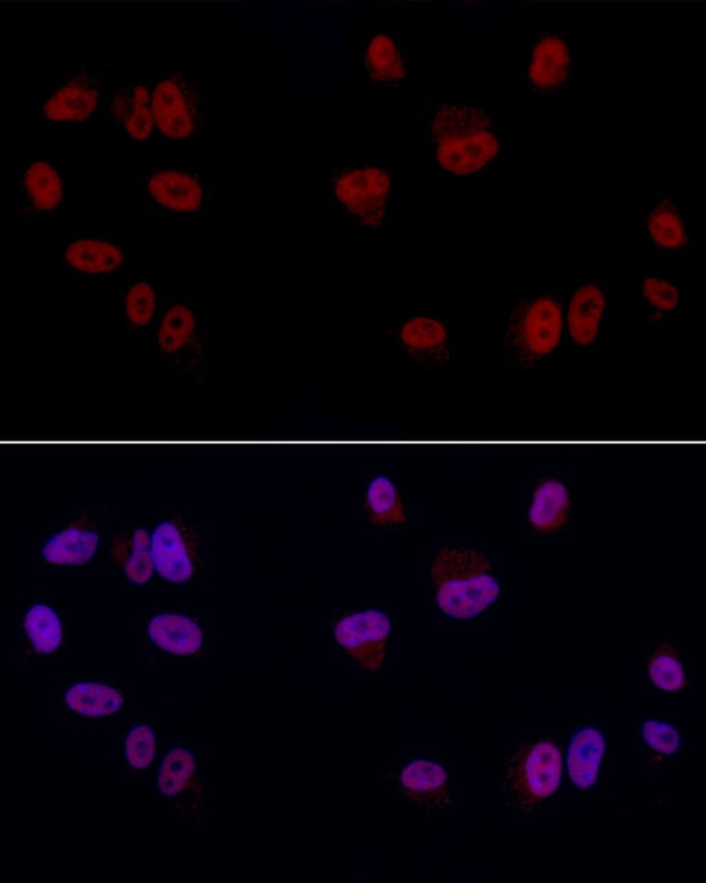 100UL GAS41 ANTIBODY 100 ul