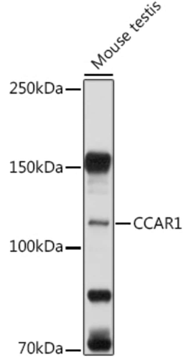 100UL CCAR1 ANTIBODY 100 ul