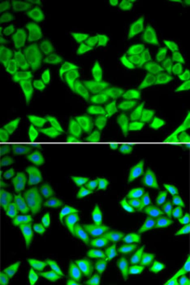 100UL CIAPIN1 ANTIBODY 100 ul