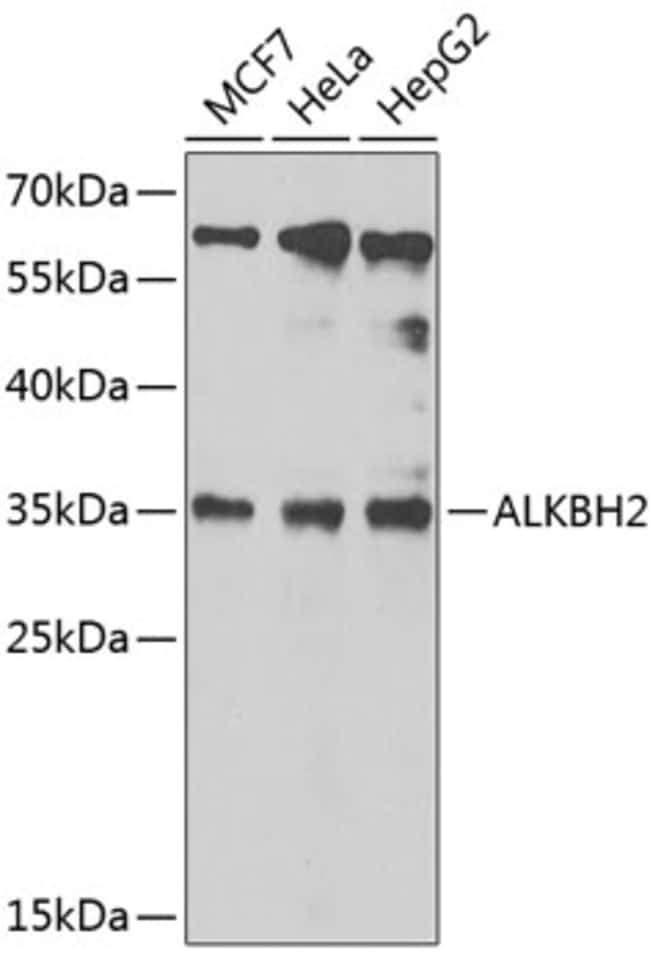 100UL ALKBH2 ANTIBODY 100 ul