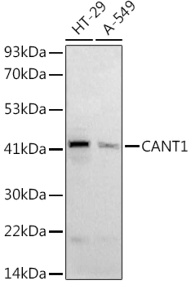 100UL CANT1 ANTIBODY 100 ul