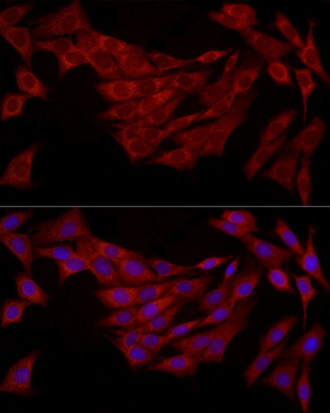 100UL FABP5 ANTIBODY 100 ul