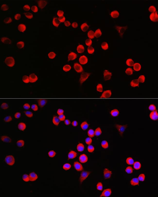 100UL GAP43 ANTIBODY 100 ul