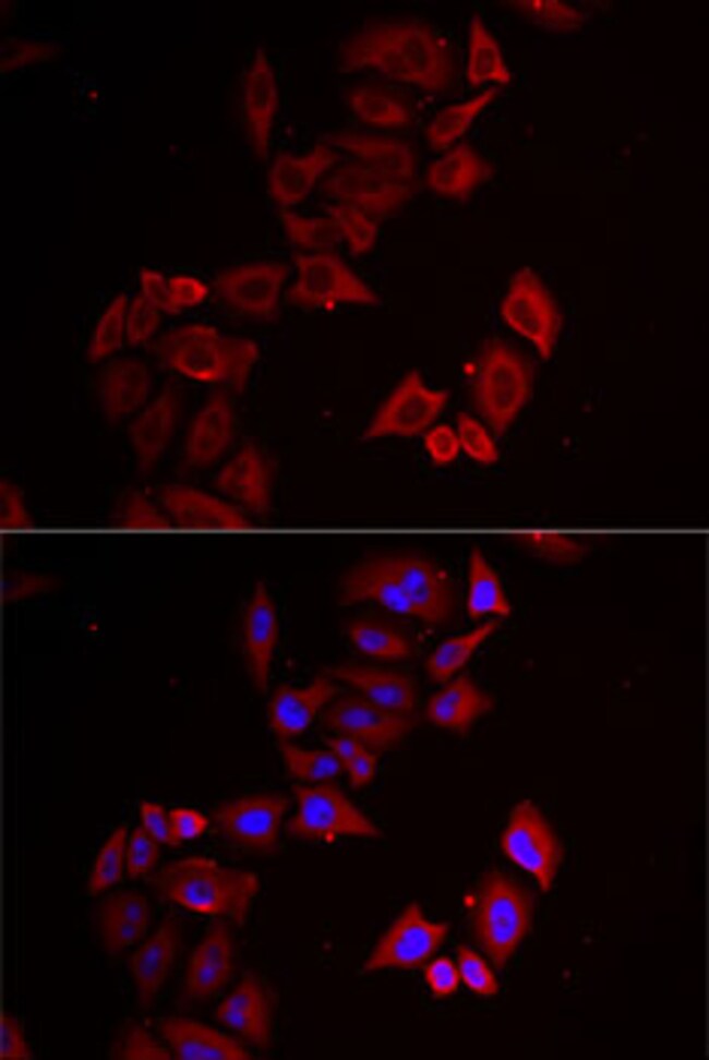 100UL LIMS1 ANTIBODY 100 ul