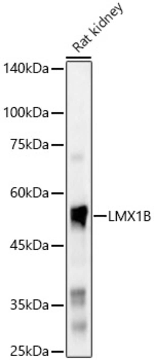 100UL LMX1B ANTIBODY 100 ul