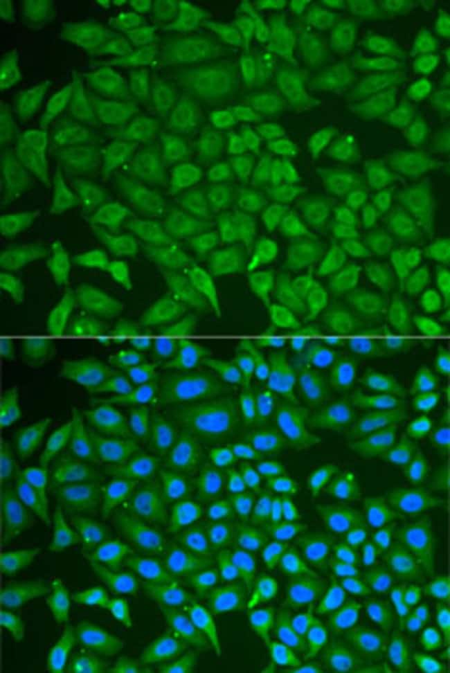 100UL GCDFP-15 ANTIBODY 100 ul