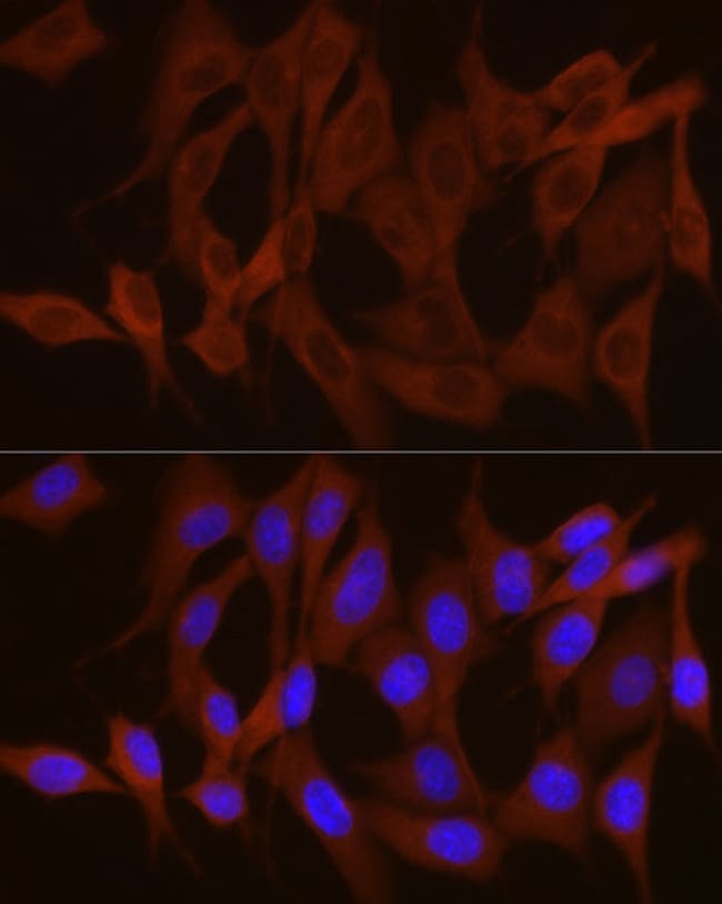 100UL GPBB ANTIBODY 100 ul