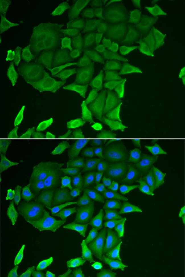 100UL CD84 ANTIBODY 100 ul