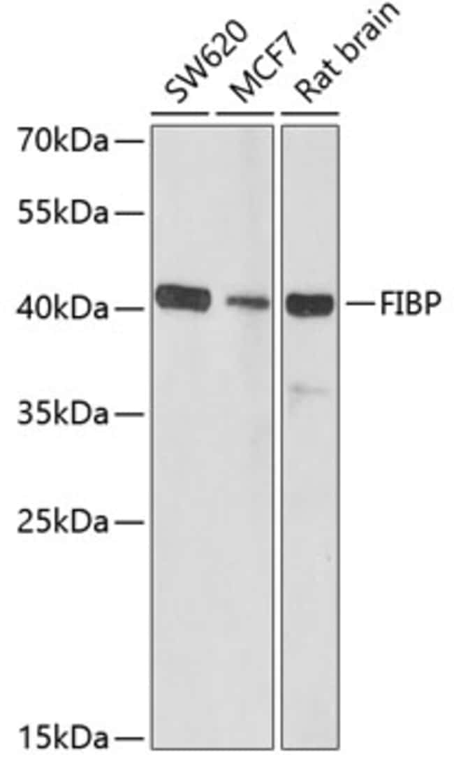 100UL FIBP ANTIBODY 100 ul