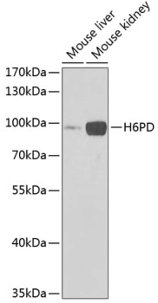 100UL H6PD ANTIBODY 100 ul