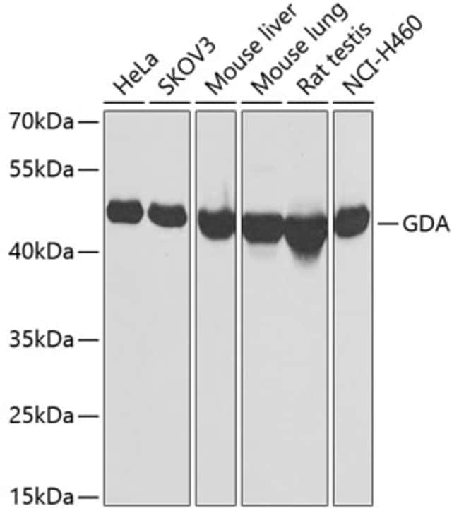 100UL GDA ANTIBODY 100 ul