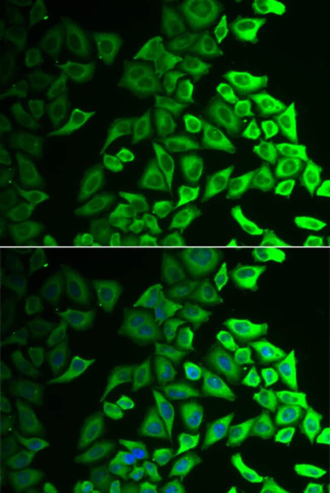 100UL IL18BP ANTIBODY 100 ul