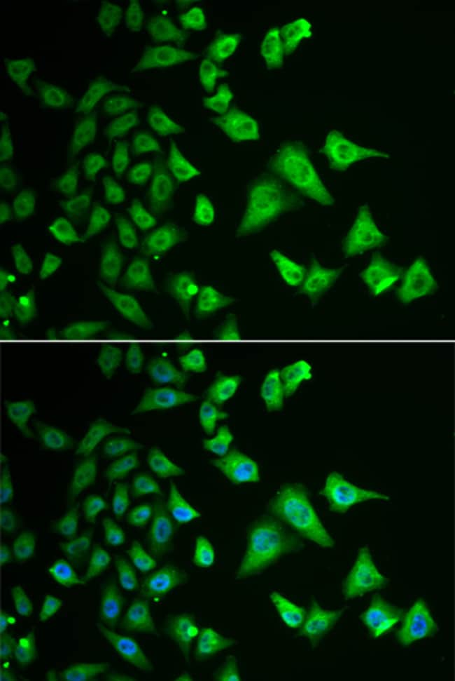 100UL DHRS2 ANTIBODY 100 ul