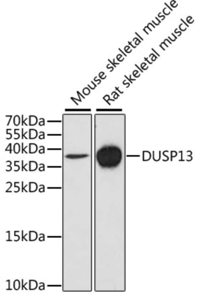 100UL DUSP13 ANTIBODY 100 ul