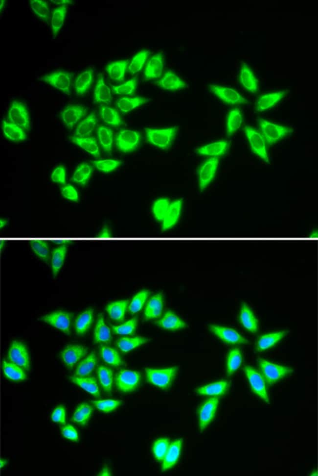 100UL BIT1 ANTIBODY 100 ul
