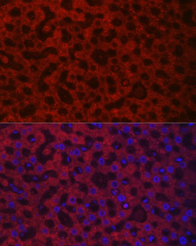 100UL HAO1 ANTIBODY 100 ul