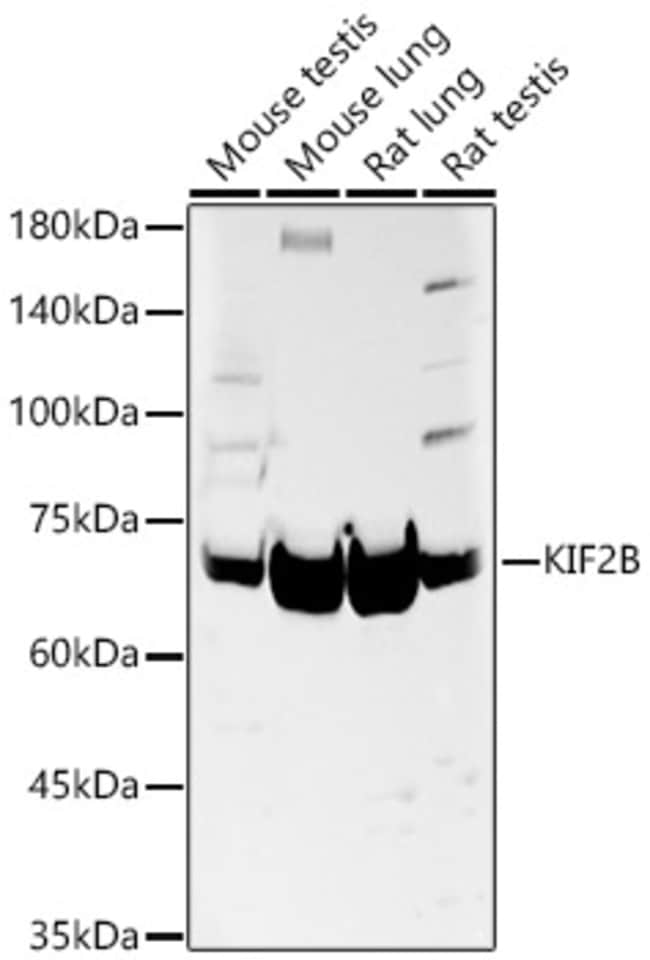 100UL KIF2B ANTIBODY 100 ul