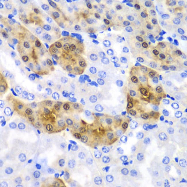 100UL HPD ANTIBODY 100 ul