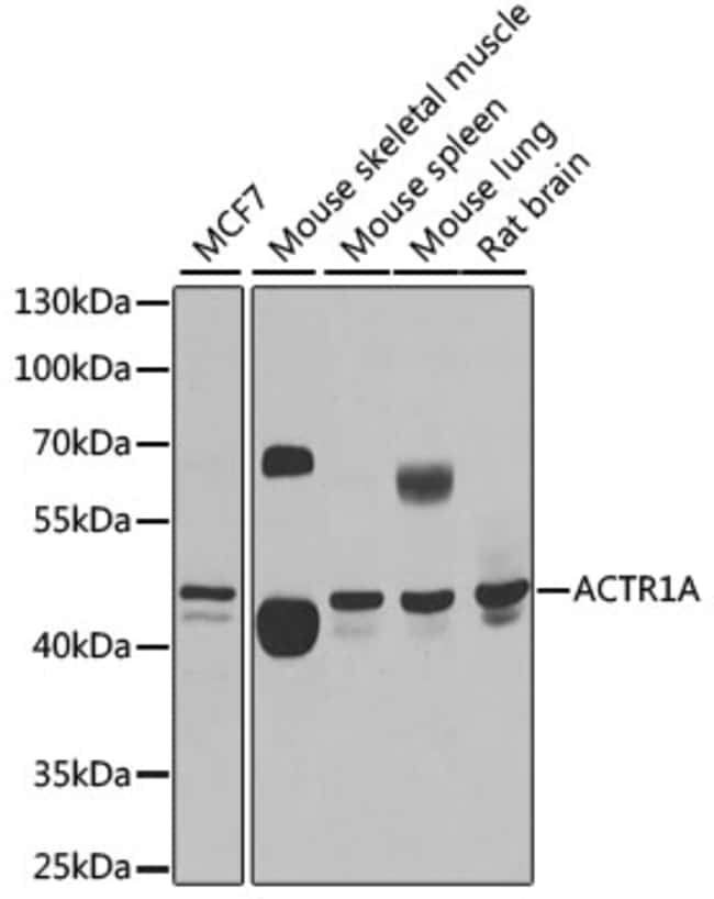 100UL ACTR1A ANTIBODY 100 ul