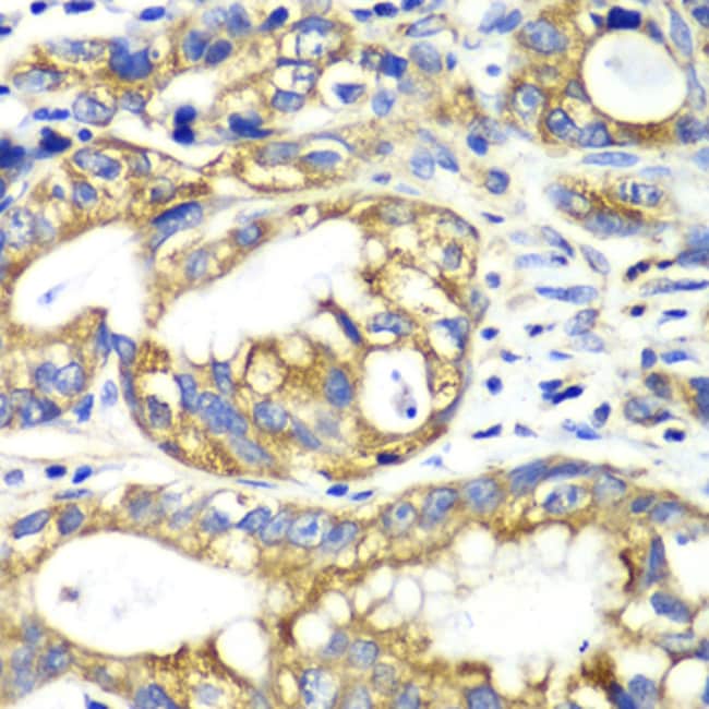 100UL ADENYLATE KINASE 2 ANTIBODY 100 ul