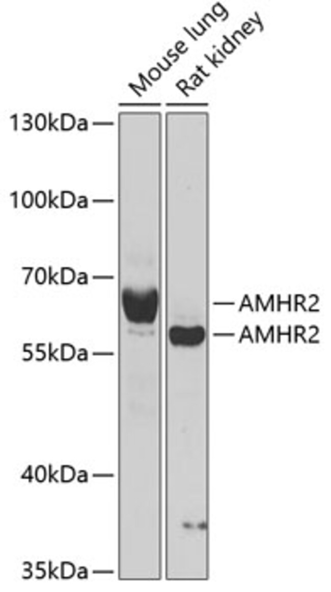 100UL AMHR2 ANTIBODY 100 ul