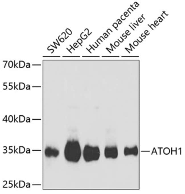100UL MATH1 ANTIBODY 100 ul