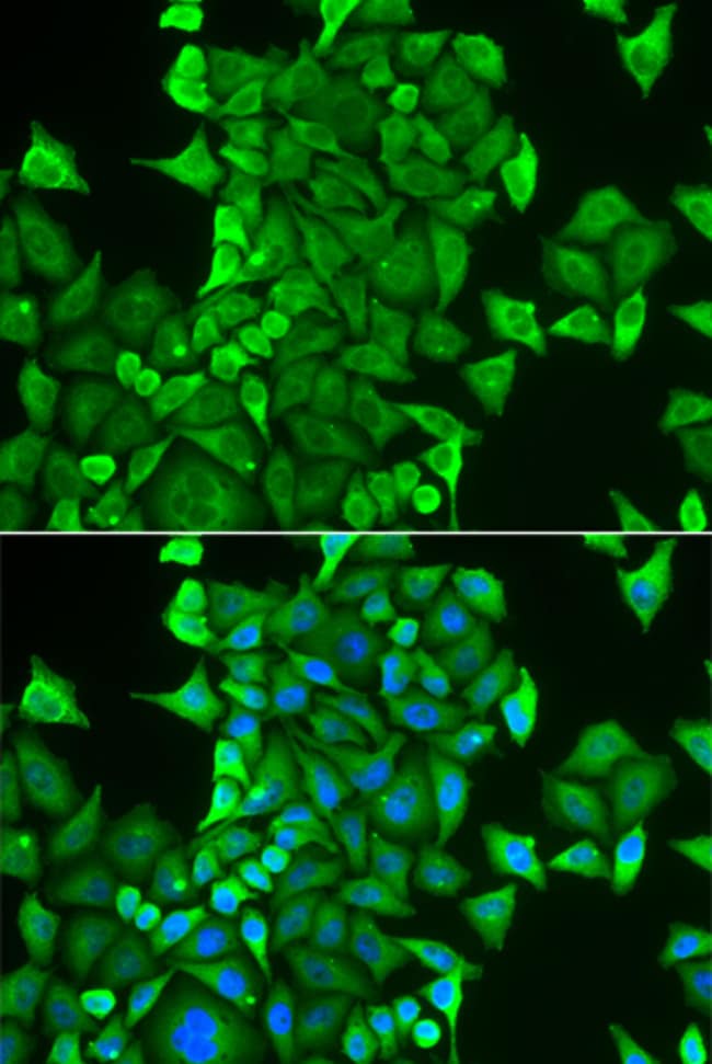 100UL CARS ANTIBODY 100 ul
