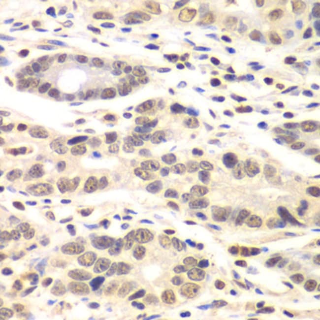 100UL CYCLIN C ANTIBODY 100 ul
