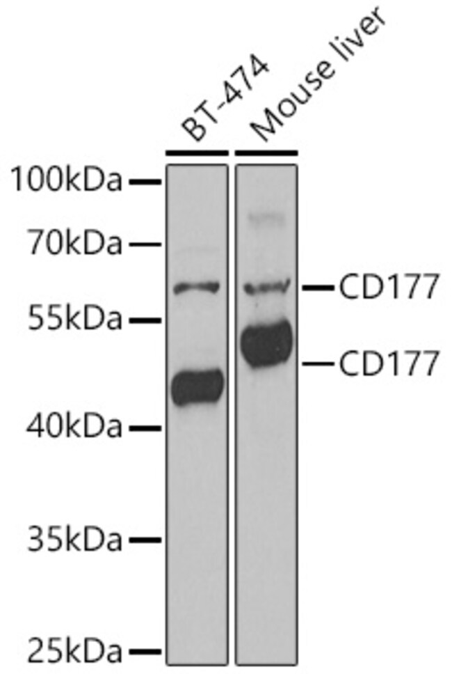 100UL CD177 ANTIBODY 100 ul