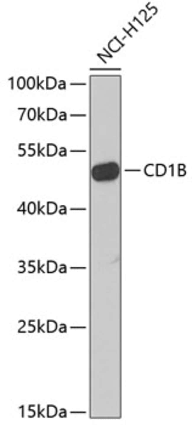 100UL CD1B ANTIBODY 100 ul